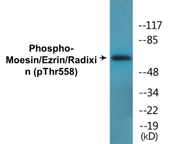 Radixin (phospho Thr558) Cell Based ELISA Kit (A102056-296)