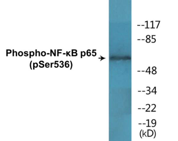 NF-kB p65 (phospho Ser536) Cell Based ELISA Kit (A103771-296)