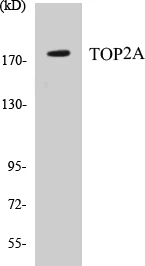 TOP2A Cell Based ELISA Kit (A103668-96)