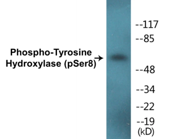 Tyrosine Hydroxylase (phospho Ser8) Cell Based ELISA Kit (A102791-296)