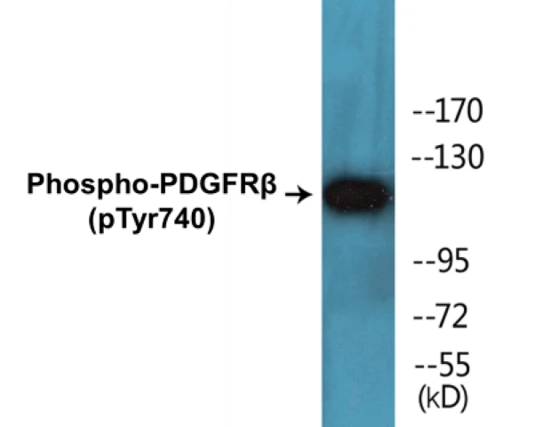 PDGFR beta (phospho Tyr740) Cell Based ELISA Kit (A102510-296)