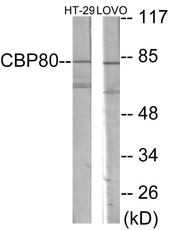 NCBP1 Cell Based ELISA Kit (A103158-96)