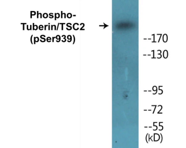 Tuberin (phospho Ser939) Cell Based ELISA Kit (A102047-296)