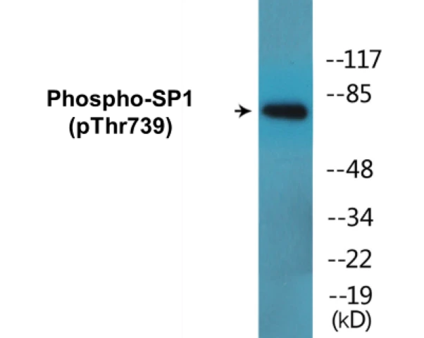 SP1 (phospho Thr739) Cell Based ELISA Kit (A102442-296)