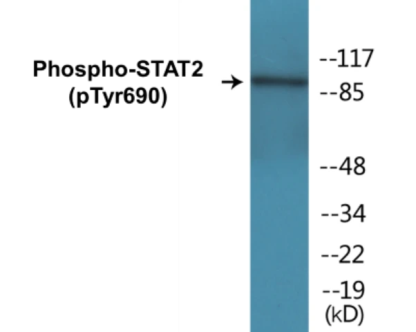 STAT2 (phospho Tyr690) Cell Based ELISA Kit (A102697-296)