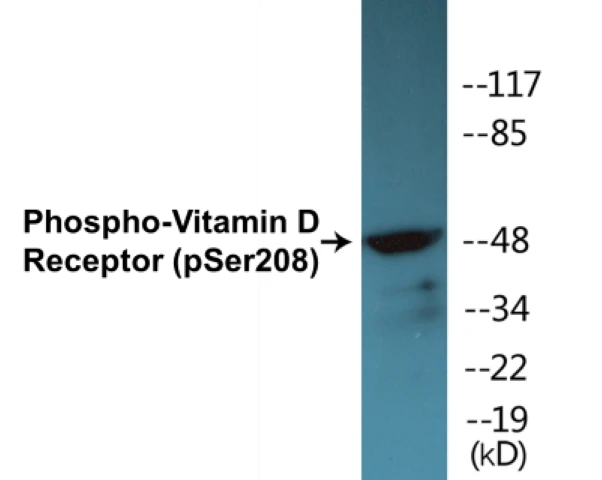 Vitamin D Receptor (phospho Ser208) Cell Based ELISA Kit (A102703-296)