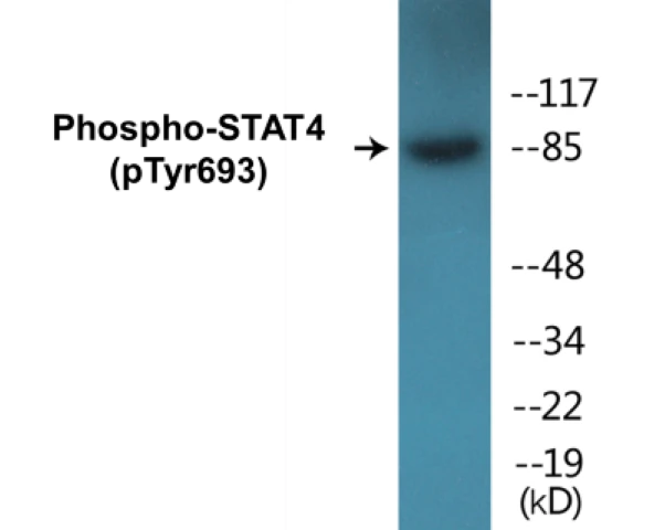 STAT4 (phospho Tyr693) Cell Based ELISA Kit (A103809-296)