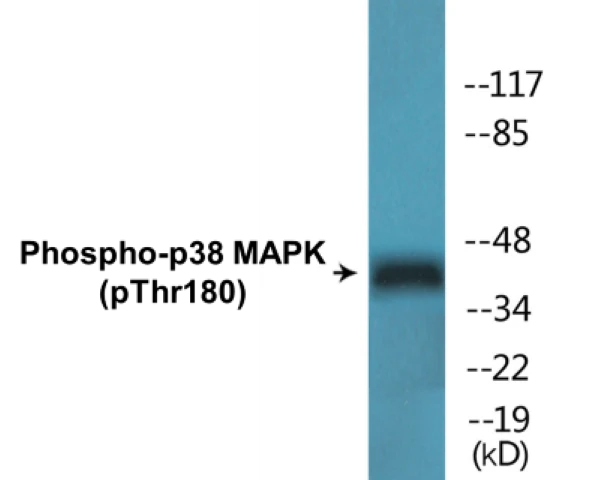 p38 MAPK (phospho Thr180) Cell Based ELISA Kit (A103773-296)