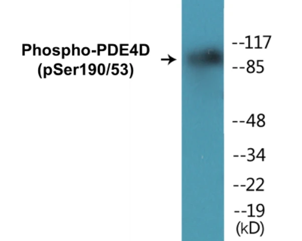 PDE4D (phospho Ser190 + Ser53) Cell Based ELISA Kit (A102467-296)