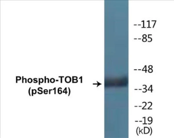 TOB1 (phospho Ser164) Cell Based ELISA Kit (A102359-296)