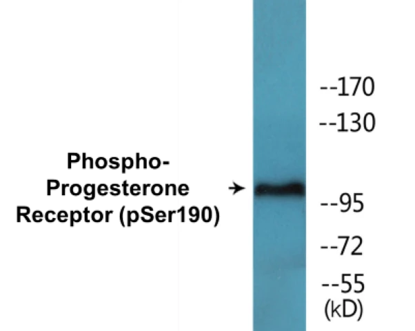 Progesterone Receptor (phospho Ser190) Cell Based ELISA Kit (A102749-296)