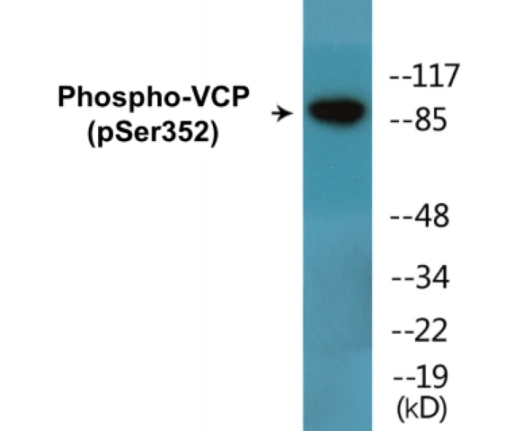 VCP (phospho Ser352) Cell Based ELISA Kit (A102454-296)