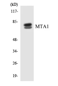 MTA1 Cell Based ELISA Kit (A103292-96)