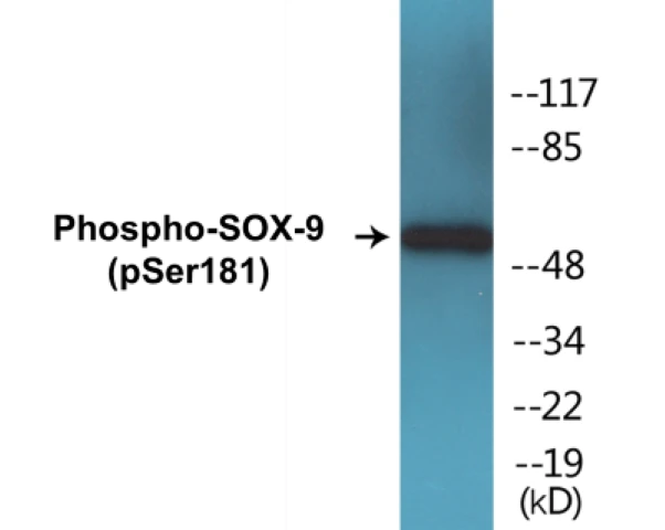 SOX-9 (phospho Ser181) Cell Based ELISA Kit (A102618-296)