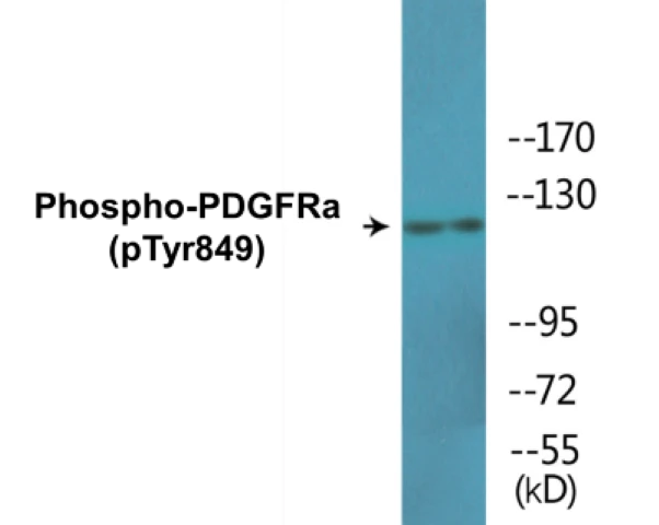 PDGFRa (phospho Tyr849) Cell Based ELISA Kit (A102088-296)