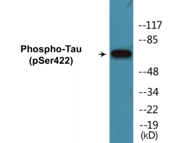 Tau (phospho Ser422) Cell Based ELISA Kit (A102445-296)