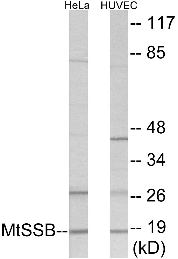 MtSSB Cell Based ELISA Kit (A103156-96)