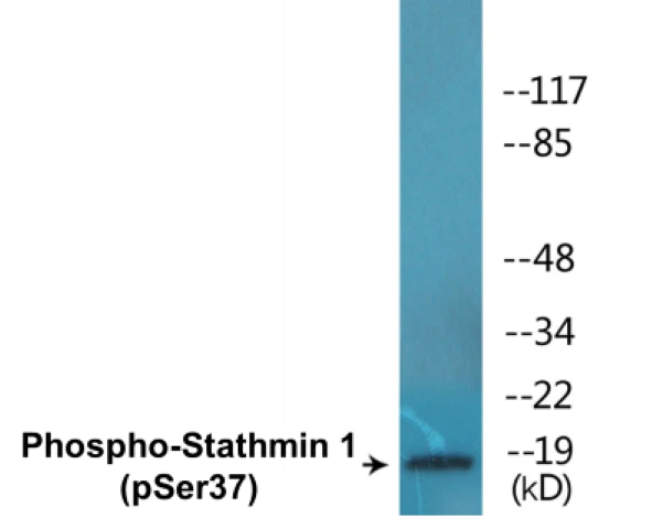 Stathmin 1 (phospho Ser37) Cell Based ELISA Kit (A102564-296)