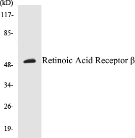 Retinoic Acid Receptor beta Cell Based ELISA Kit (A103365-96)