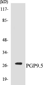 PGP9.5 Cell Based ELISA Kit (A103013-96)