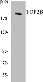 TOP2B Cell Based ELISA Kit (A103425-96)