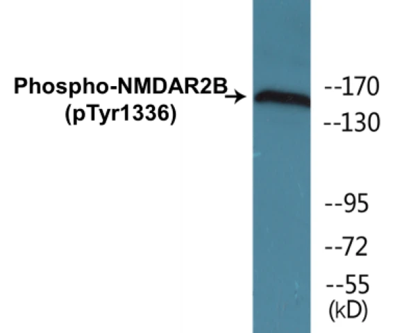 NMDAR2B (phospho Tyr1336) Cell Based ELISA Kit (A102592-296)