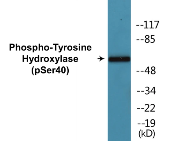 Tyrosine Hydroxylase (phospho Ser40) Cell Based ELISA Kit (A102479-296)