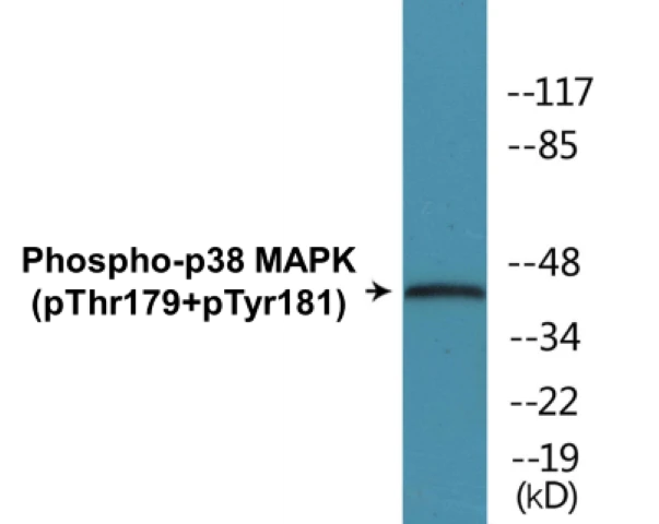 p38 MAPK (phospho Thr179+Tyr181) Cell Based ELISA Kit (A102238-296)