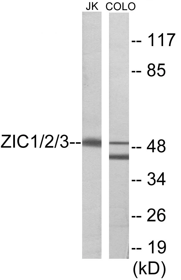 ZIC1 + 2 + 3 Cell Based ELISA Kit (A103369-96)