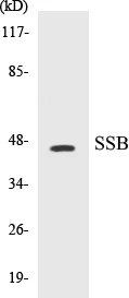 SSB Cell Based ELISA Kit (A103750-96)