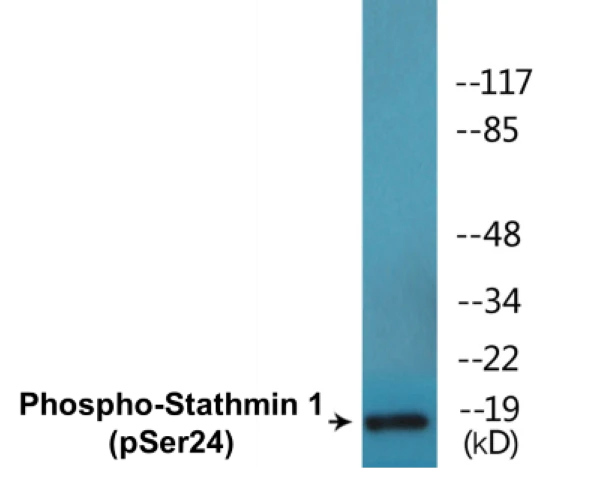 Stathmin 1 (phospho Ser24) Cell Based ELISA Kit (A102563-296)