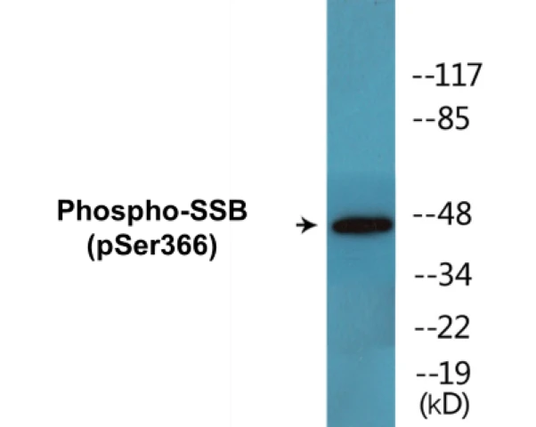 SSB (phospho Ser366) Cell Based ELISA Kit (A102757-296)