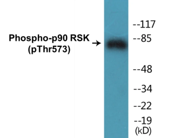 p90RSK (phospho Thr573) Cell Based ELISA Kit (A102074-296)