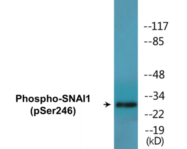 SNAI1 (phospho Ser246) Cell Based ELISA Kit (A102614-296)