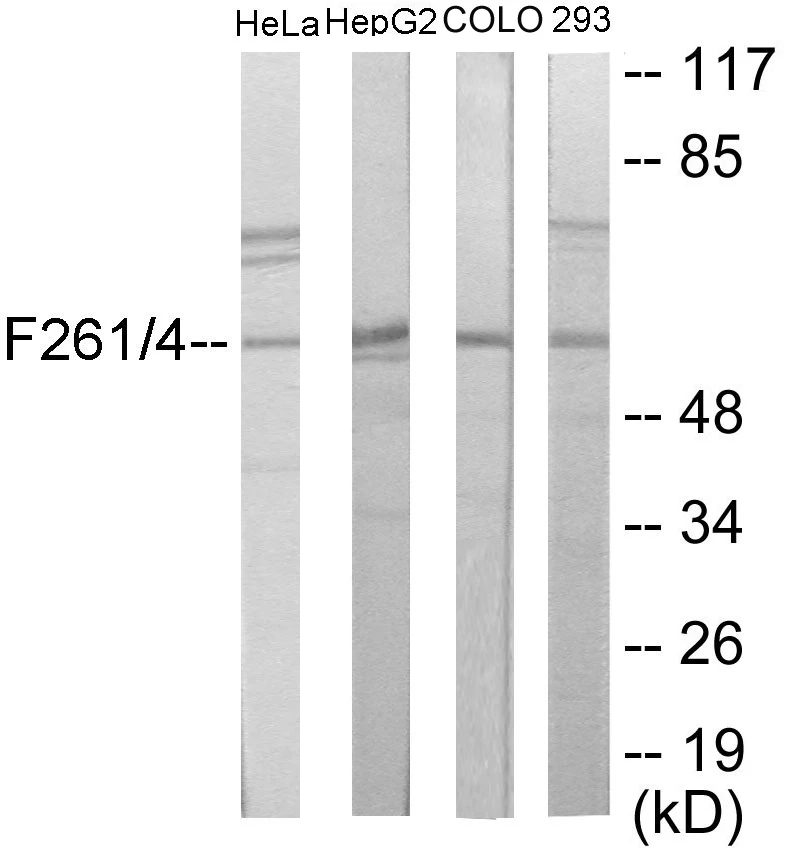 PFKFB1 + 4 Cell Based ELISA Kit (A102884-96)