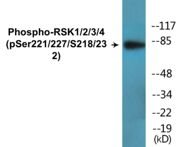 RSK1 + 2 + 3 + 4 (phospho Ser221 + Ser227 + Ser218 + Ser232) Cell Based ELISA Kit (A102635-296)