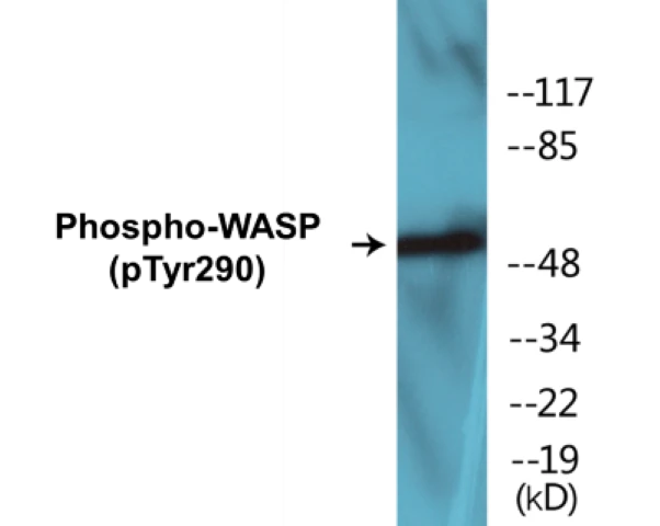 WASP (phospho Tyr290) Cell Based ELISA Kit (A102645-296)