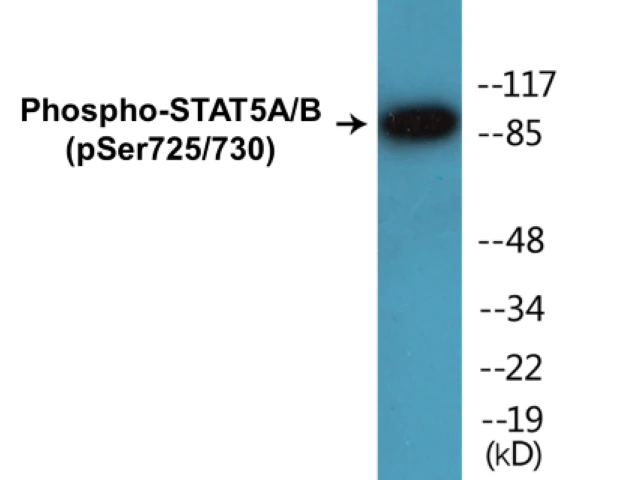 STAT5A + B (phospho Ser725 + Ser730) Cell Based ELISA Kit (A102461-296)