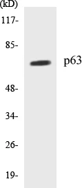 p63 Cell Based ELISA Kit (A103337-96)