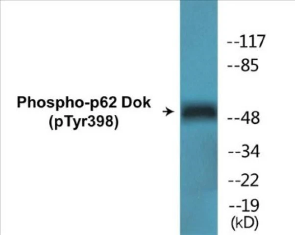 p62 Dok (phospho Tyr398) Cell Based ELISA Kit (A102060-296)