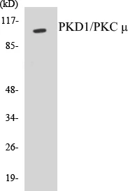 PKD1 Cell Based ELISA Kit (A103255-96)