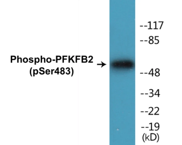 PFKFB2 (phospho Ser483) Cell Based ELISA Kit (A102099-296)