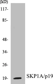 SKP1A Cell Based ELISA Kit (A103115-96)