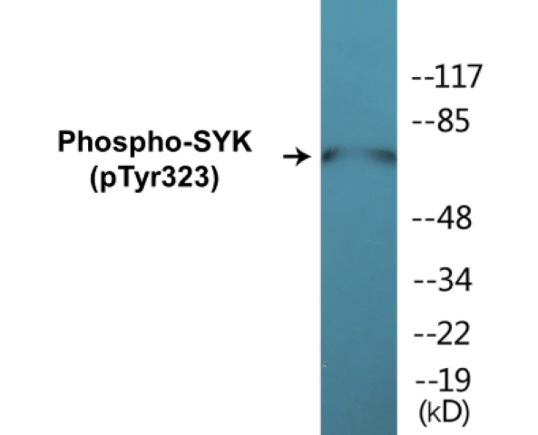 SYK (phospho Tyr323) Cell Based ELISA Kit (A103832-296)