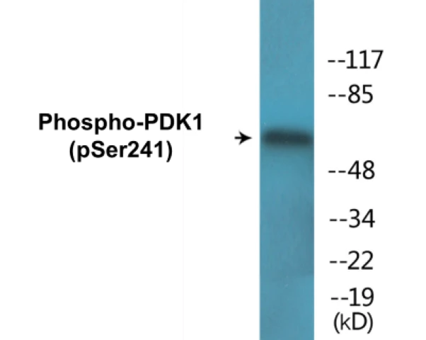 PDK1 (phospho Ser241) Cell Based ELISA Kit (A102341-296)