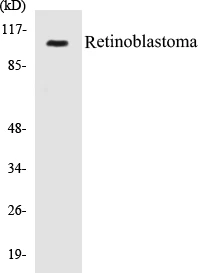 Retinoblastoma Cell Based ELISA Kit (A102836-96)