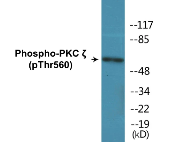 PKC zeta (phospho Thr560) Cell Based ELISA Kit (A102582-296)