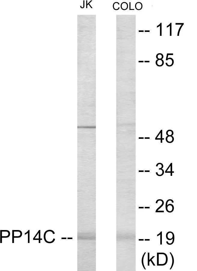 PPP1R14C Cell Based ELISA Kit (A102968-96)