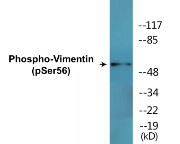 Vimentin (phospho Ser56) Cell Based ELISA Kit (A102705-296)