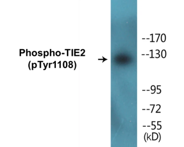 TIE2 (phospho Tyr1108) Cell Based ELISA Kit (A102610-296)